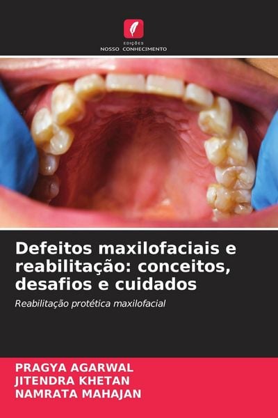 Produktbild: Defeitos maxilofaciais e reabilita&ccedil;&atilde;o: conceitos, desafios e cuidados