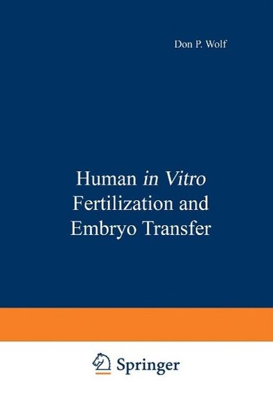 Produktbild: Human in Vitro Fertilization and Embryo Transfer