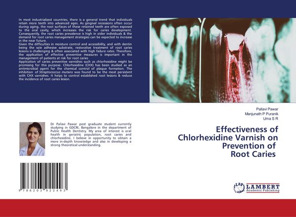 Produktbild: Effectiveness of Chlorhexidine Varnish on Prevention of Root Caries