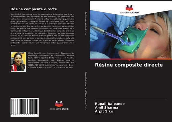 Produktbild: R&eacute;sine composite directe