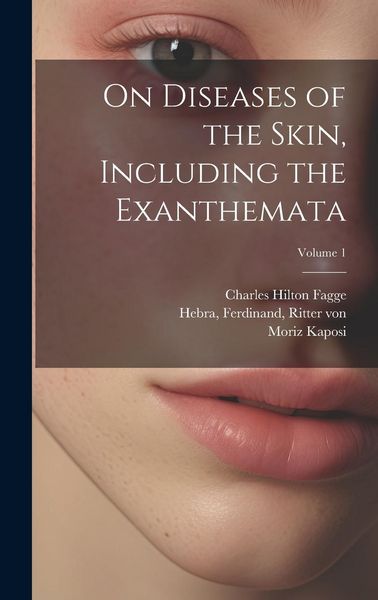 Produktbild: On Diseases of the Skin, Including the Exanthemata; Volume 1