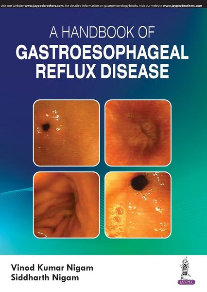 Produktbild: A Handbook of Gastroesophageal Reflux Disease (GERD)