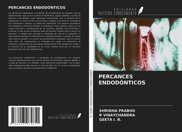 Produktbild: Percances Endod&oacute;nticos