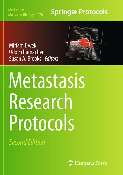 Produktbild: Metastasis Research Protocols