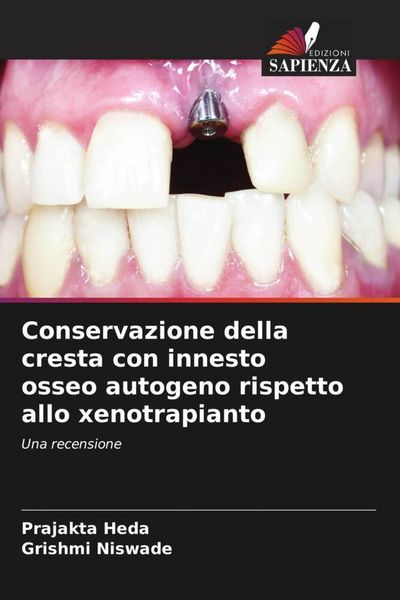 Produktbild: Conservazione della cresta con innesto osseo autogeno rispetto allo xenotrapianto
