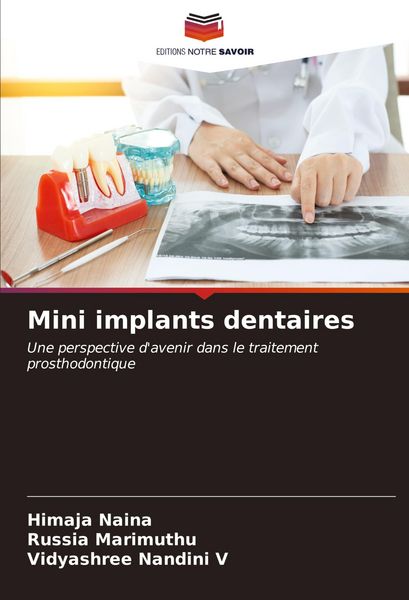 Produktbild: Mini implants dentaires