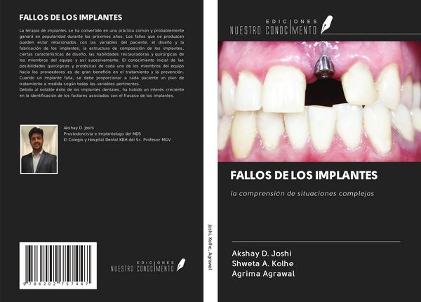 Produktbild: Fallos De Los Implantes