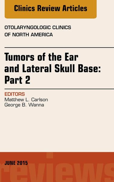 Produktbild: Tumors of the Ear and Lateral Skull Base: PART 2, An Issue of Otolaryngologic Clinics of North America