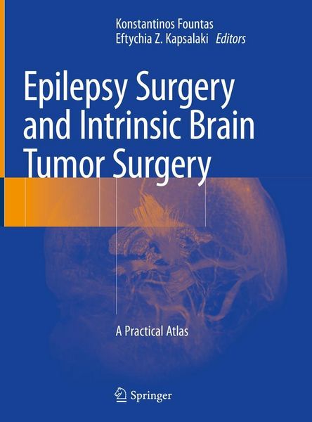 Produktbild: Epilepsy Surgery and Intrinsic Brain Tumor Surgery