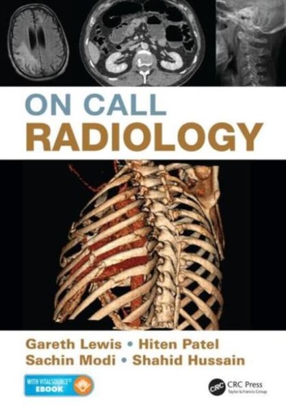 Produktbild: On Call Radiology