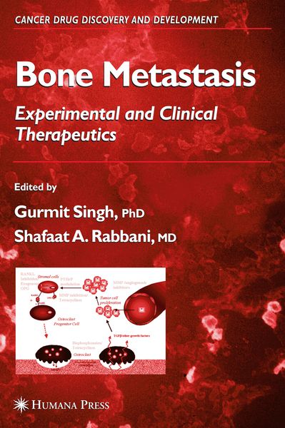Produktbild: Bone Metastasis