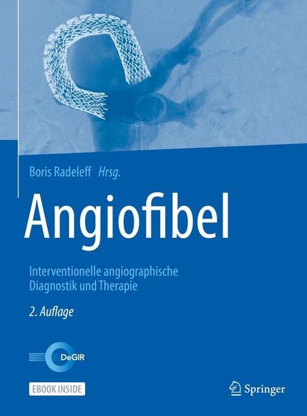 Produktbild: Angiofibel