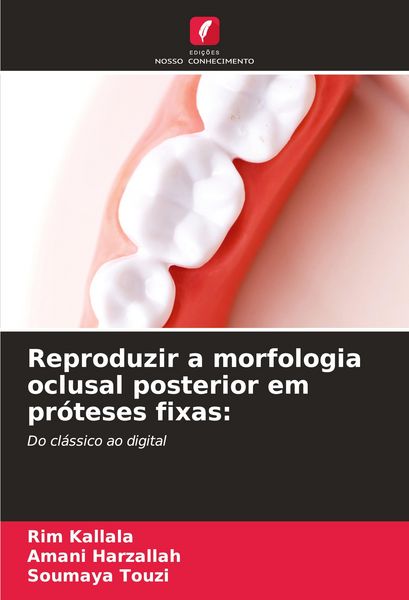 Produktbild: Reproduzir a morfologia oclusal posterior em pr&oacute;teses fixas: