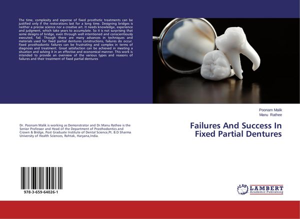 Produktbild: Failures And Success In Fixed Partial Dentures