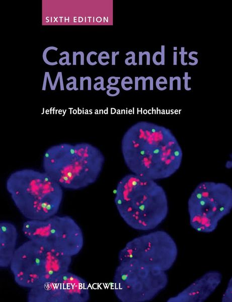Produktbild: Cancer and its Management