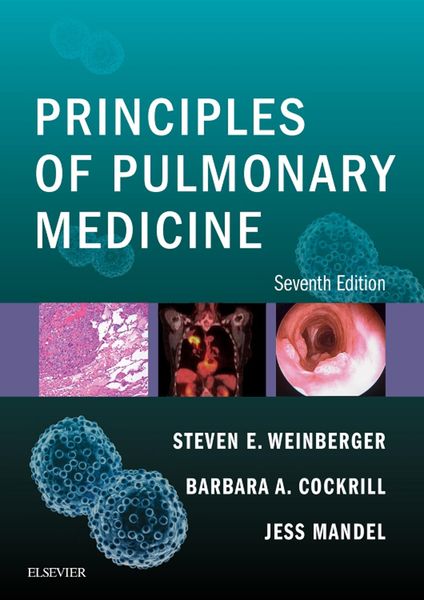 Produktbild: Principles of Pulmonary Medicine E-Book