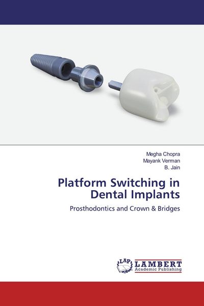 Produktbild: Platform Switching in Dental Implants