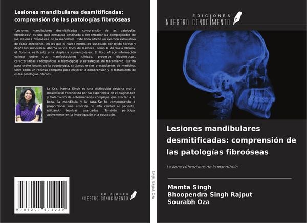 Produktbild: Lesiones mandibulares desmitificadas: comprensi&oacute;n de las patolog&iacute;as fibro&oacute;seas