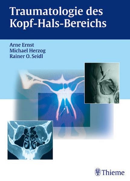 Produktbild: Traumatologie des Kopf-Hals-Bereichs