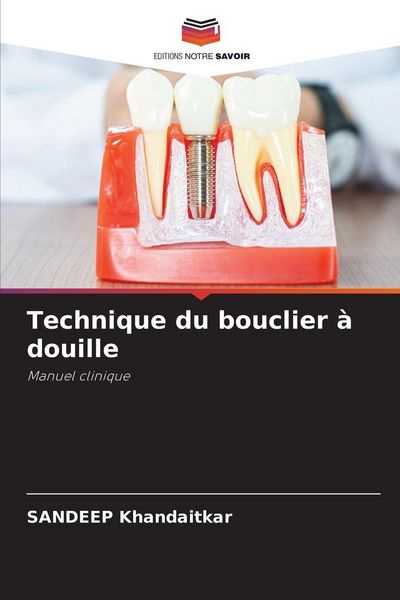 Produktbild: Technique du bouclier &agrave; douille