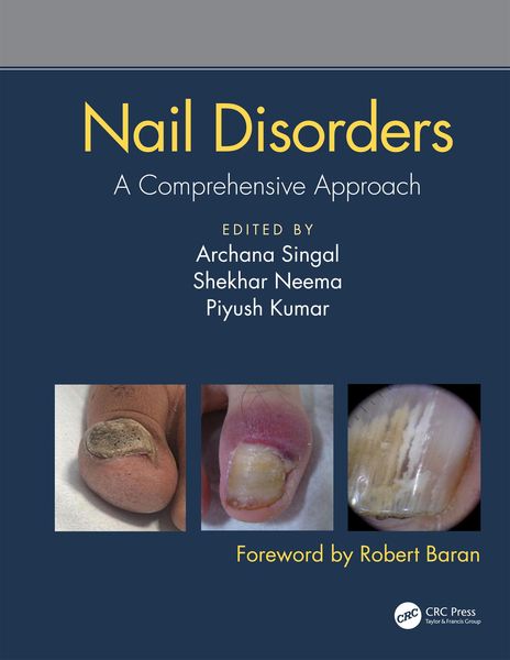 Produktbild: Nail Disorders