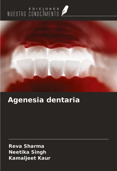 Produktbild: Agenesia dentaria