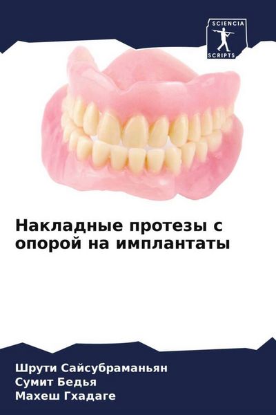 Produktbild: Nakladnye protezy s oporoj na implantaty