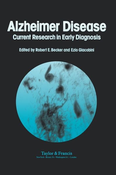 Produktbild: Alzheimer's Disease