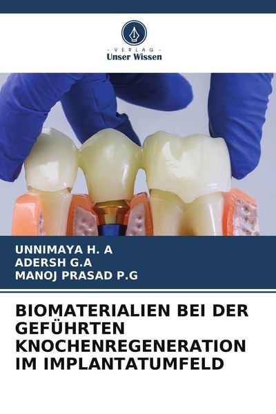 Produktbild: BIOMATERIALIEN BEI DER GEF&Uuml;HRTEN KNOCHENREGENERATION IM IMPLANTATUMFELD