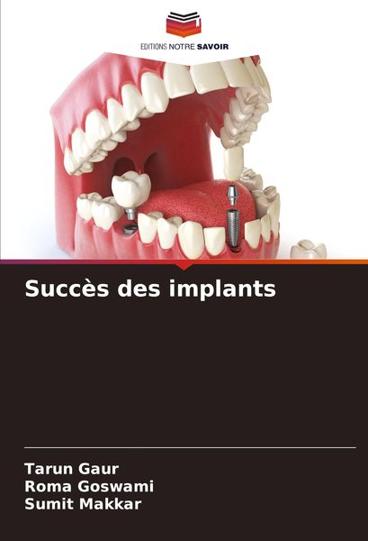 Produktbild: Succ&egrave;s des implants