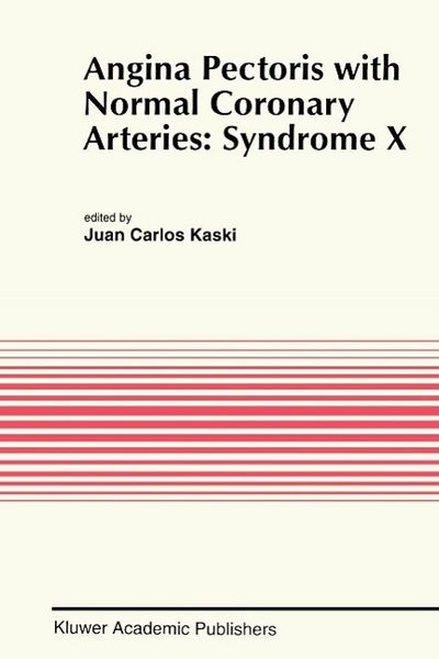 Produktbild: Angina Pectoris with Normal Coronary Arteries: Syndrome X