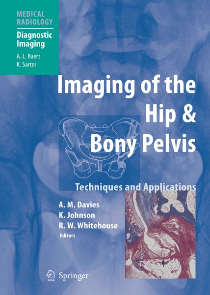 Produktbild: Imaging of the Hip & Bony Pelvis
