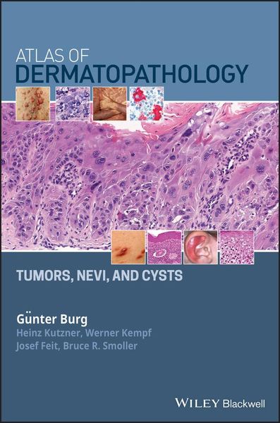Produktbild: Atlas of Dermatopathology
