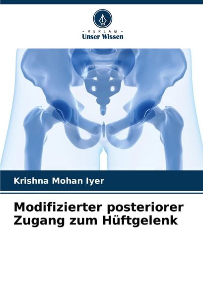 Modifizierter posteriorer Zugang zum Hüftgelenk, Taschenbuch von Krishna Mohan Iyer, Verlag Unser Wissen, 9786207499359