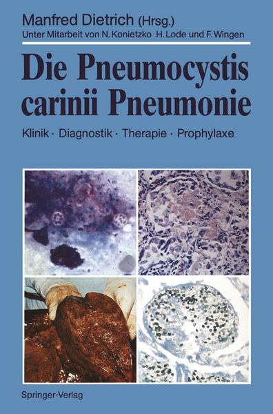 Produktbild: Die Pneumocystis carinii Pneumonie