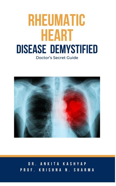 Produktbild: Rheumatic Heart Disease Demystified: Doctor's Secret Guide