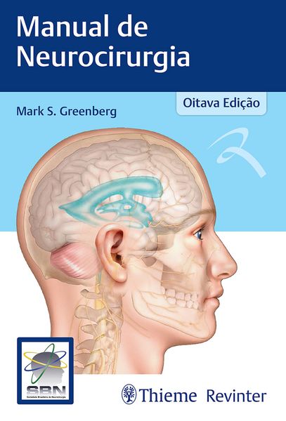 Produktbild: Manual de Neurocirurgia