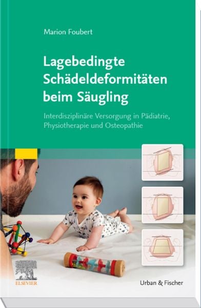 Produktbild: Lagebedingte Sch&auml;deldeformit&auml;ten beim S&auml;ugling
