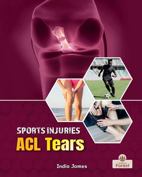 Produktbild: ACL Tears