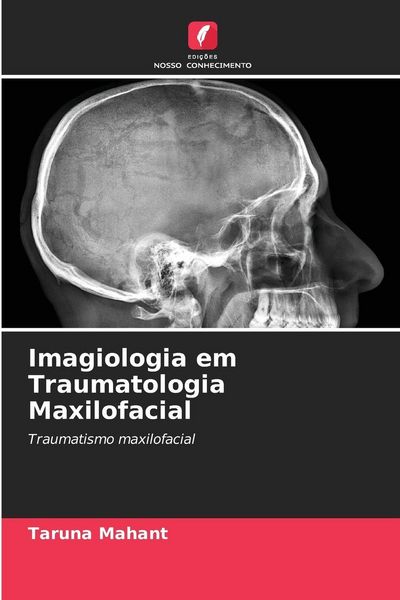Produktbild: Imagiologia em Traumatologia Maxilofacial