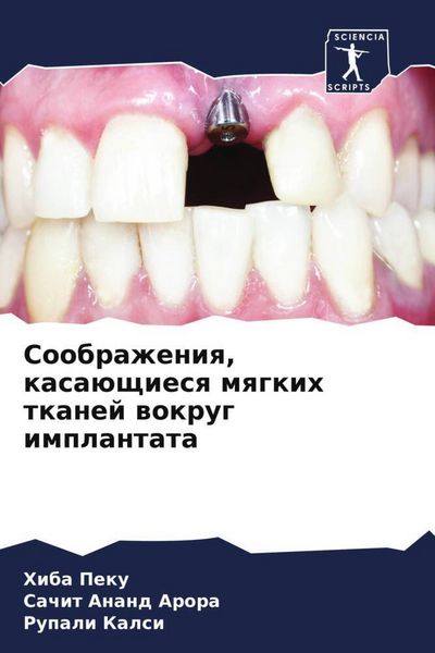 Produktbild: Soobrazheniq, kasa&uuml;schiesq mqgkih tkanej wokrug implantata