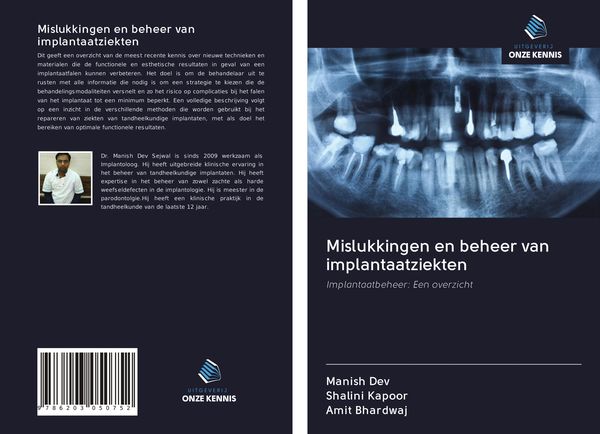 Produktbild: Mislukkingen en beheer van implantaatziekten