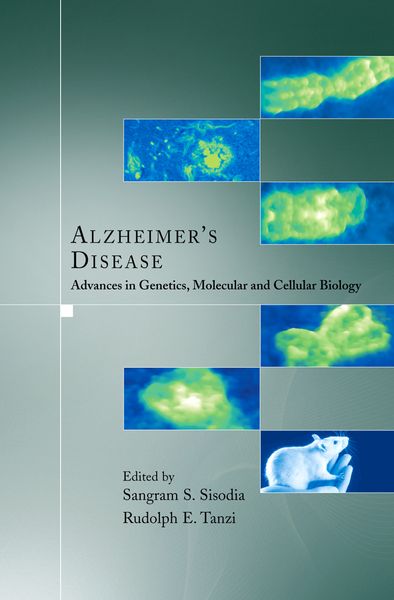 Produktbild: Alzheimer's Disease
