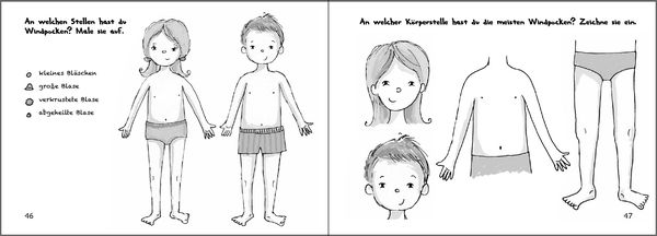 Produktbild: Wilma und die Windpocken - Das Bilder-Erz&auml;hlbuch f&uuml;r Kinder, die Windpocken haben oder mehr dar&uuml;ber wissen wollen