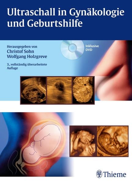 Produktbild: Ultraschall in Gyn&auml;kologie und Geburtshilfe