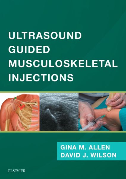 Produktbild: Ultrasound Guided Musculoskeletal Injections E-Book