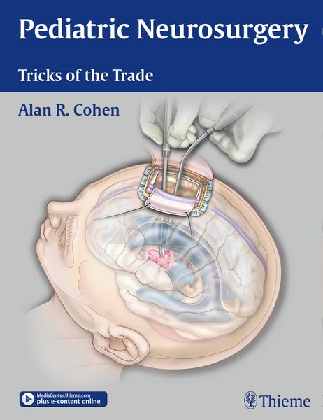 Produktbild: Pediatric Neurosurgery: Tricks of the Trade