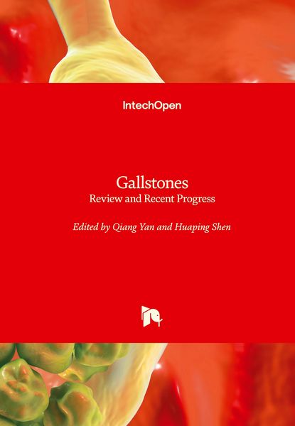 Produktbild: Gallstones