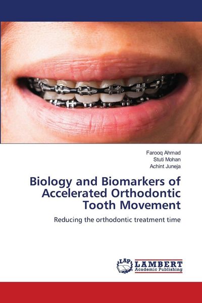 Produktbild: Biology and Biomarkers of Accelerated Orthodontic Tooth Movement