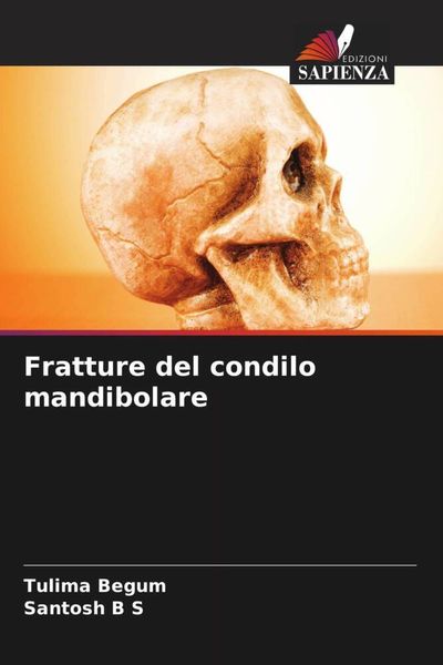 Produktbild: Fratture del condilo mandibolare